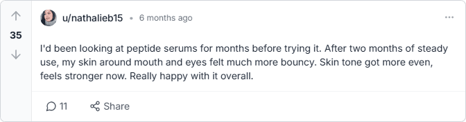 reddit review
